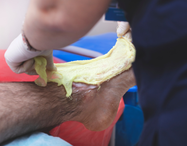 victim with burn on foot being treated by a doctor